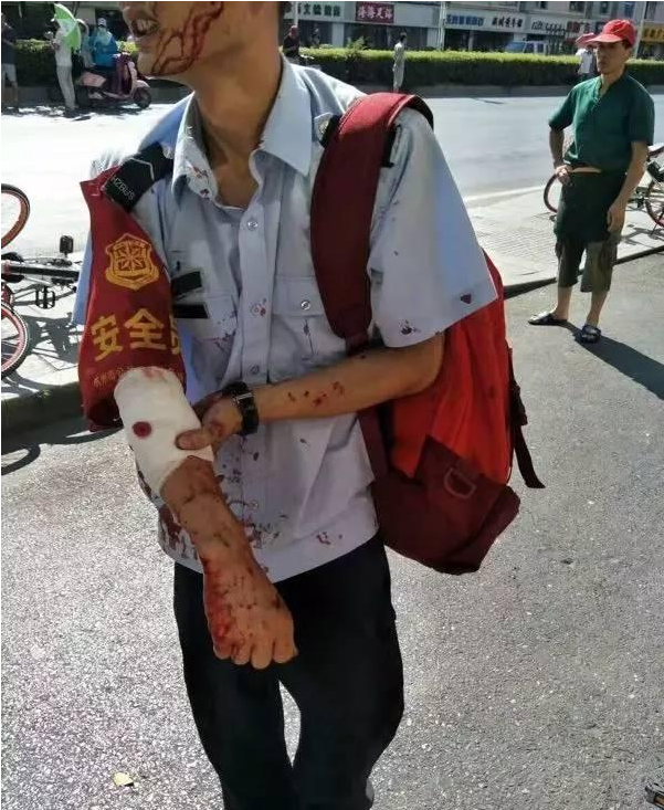 ���ݲ��^ú��ƿ��ը�º󣺏�δ���bȼ��й¶̽�y����